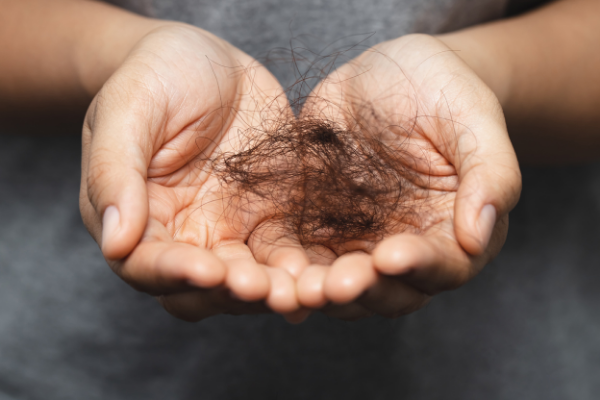 nguyên nhân gây rụng tóc và cách trị rụng tóc