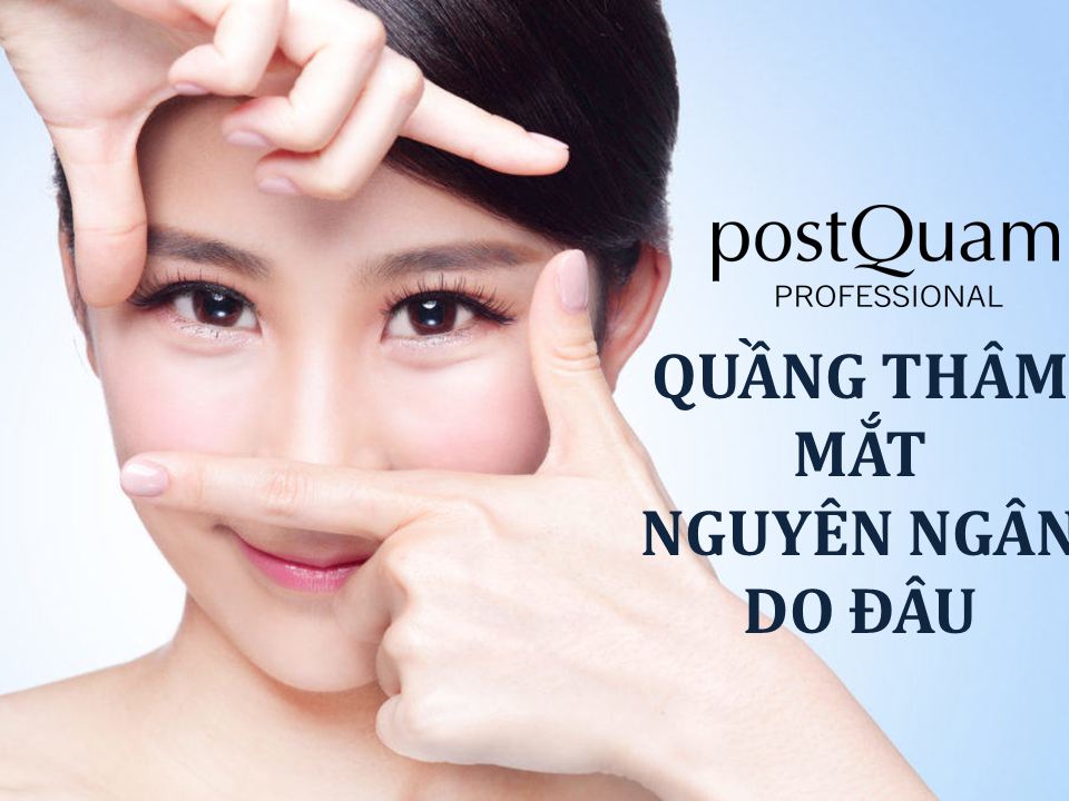 Quầng thâm mắt: Nguyên nhân do đâu?