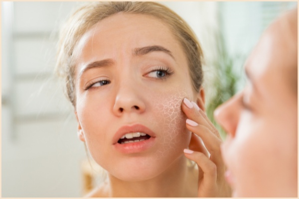 Da khô là gì Các bước chăm sóc da khô hiệu quả - Cách nhận biết da khô