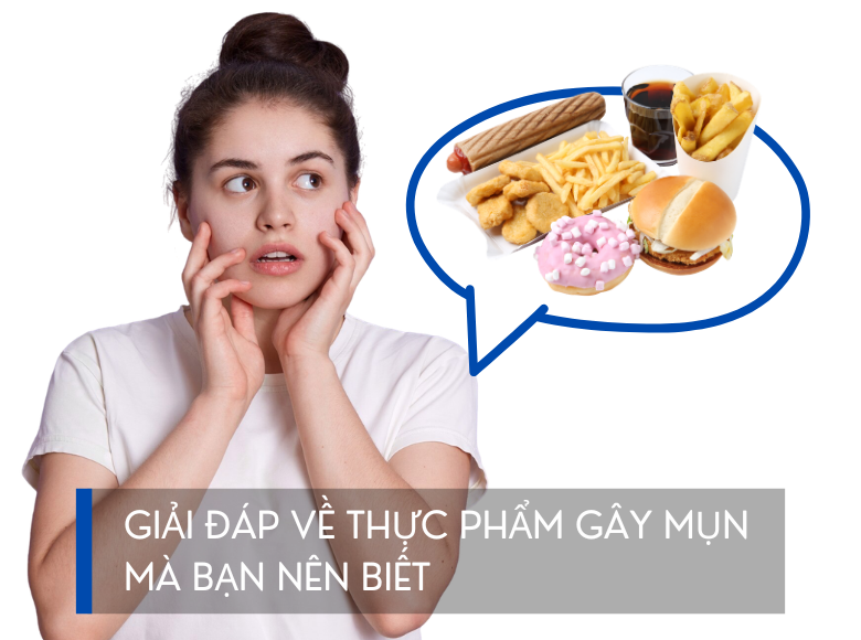 GIẢI ĐÁP VỀ THỰC PHẨM GÂY MỤN MÀ BẠN NÊN BIẾT