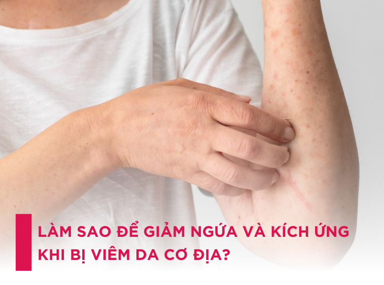 Làm Sao Để Giảm Ngứa Và Kích Ứng Khi Bị Viêm Da Cơ Địa?