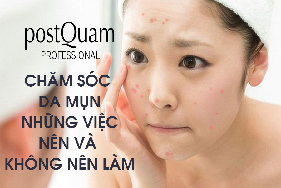 Chăm sóc da mụn: Những việc nên/ không nên làm